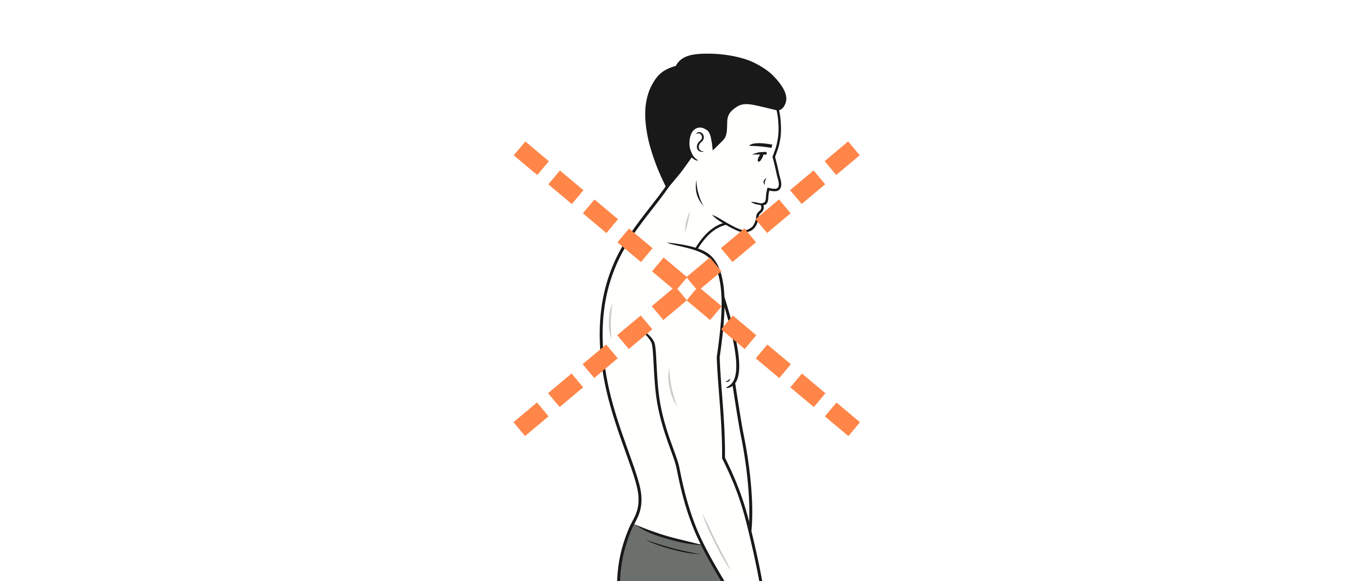 Illustration des déséquilibres posturaux