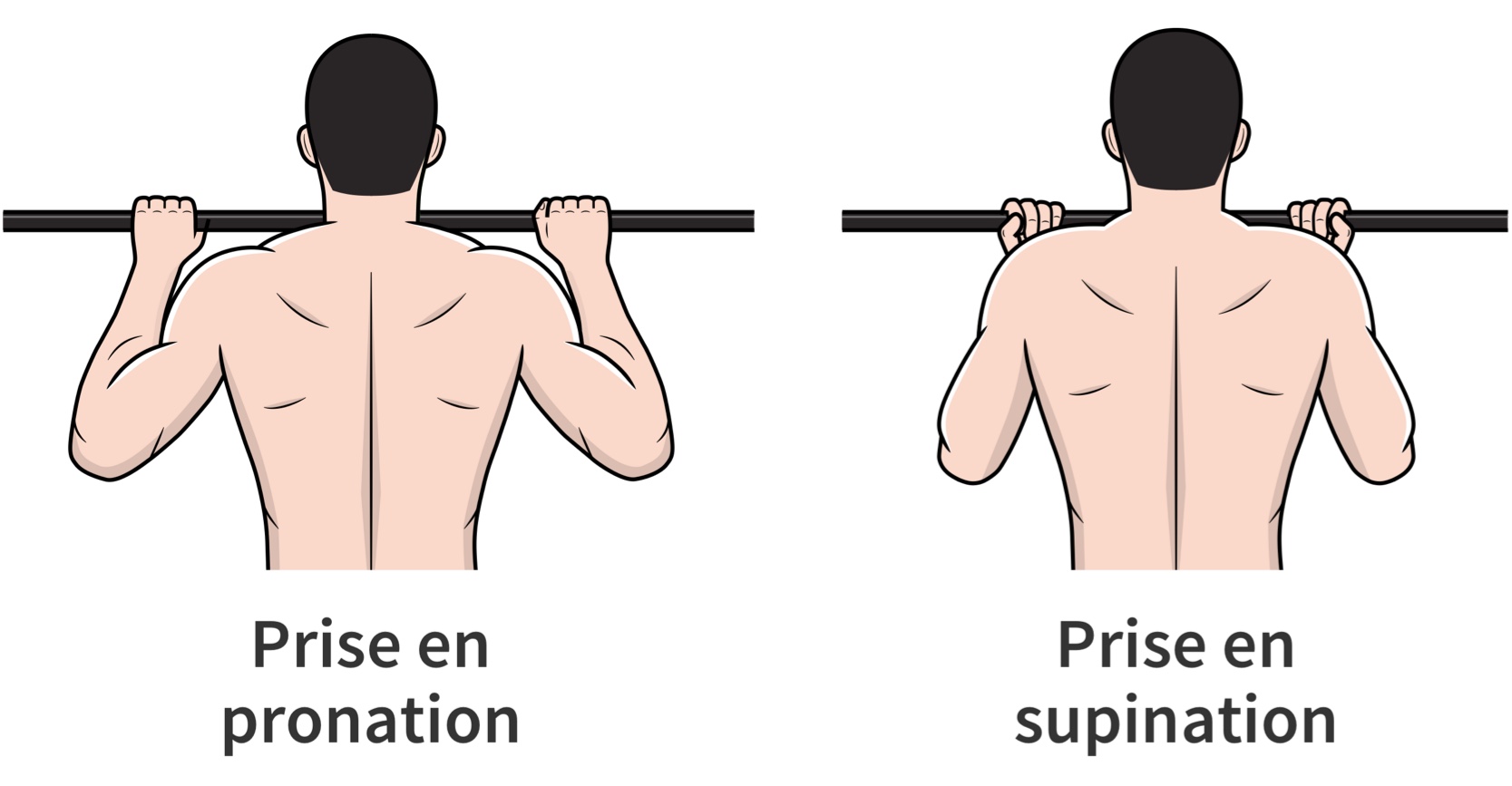 Prise en pronation vs supination au traction